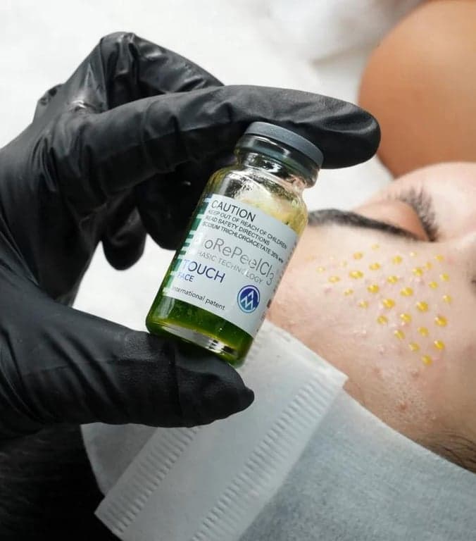 Chemical Peels treatment at House of Aesthetics, DHA Phase 6 Lahore