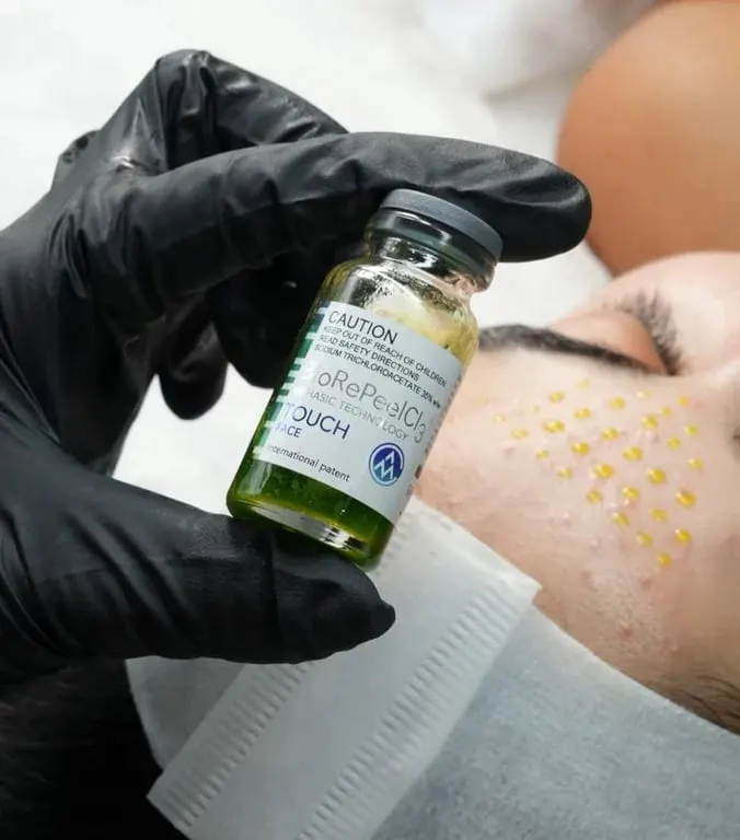 Chemical Peels treatment at House of Aesthetics, DHA Phase 6 Lahore