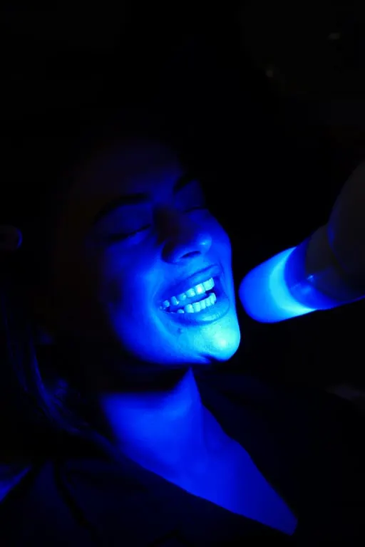 Teeth Whitening treatment at House of Aesthetics, DHA Phase 6 Lahore