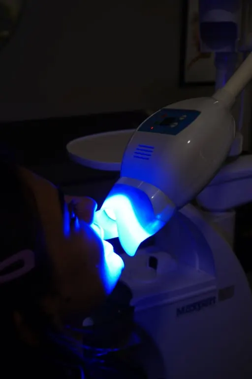 Teeth Whitening before and after result — House of Aesthetics DHA Phase 6 Lahore